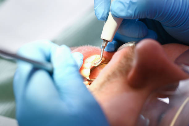 Best Emergency Tooth Extraction  in Grandview, OK